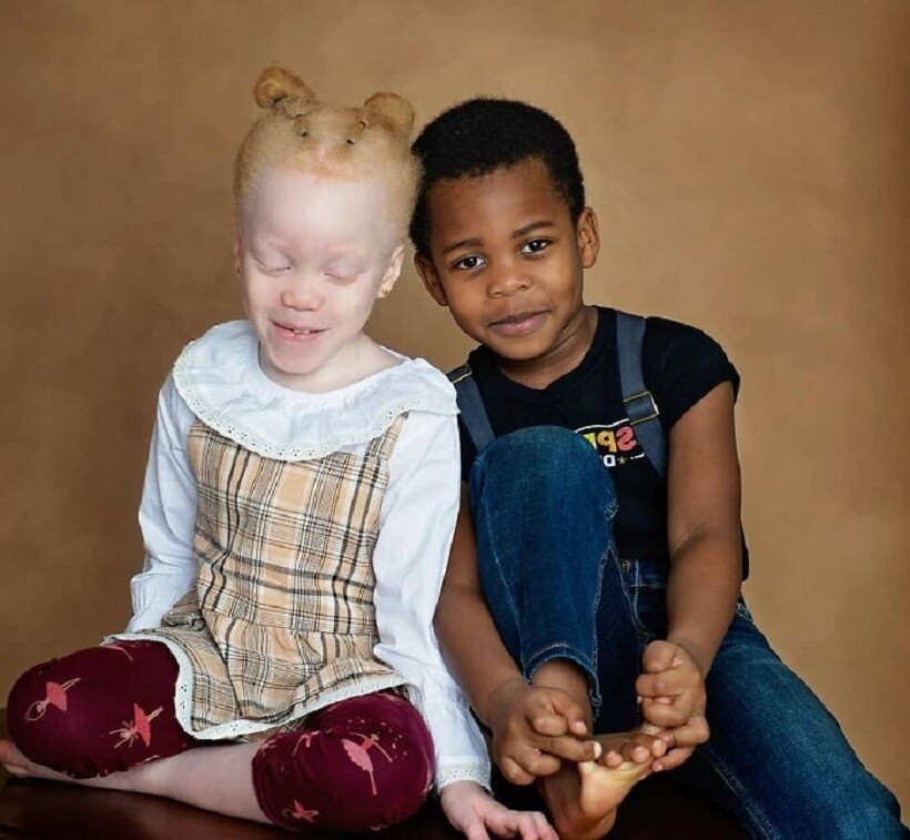 14 фото очаровательных близнецов с разным цветом кожи, ставших знаменитыми на весь мир
