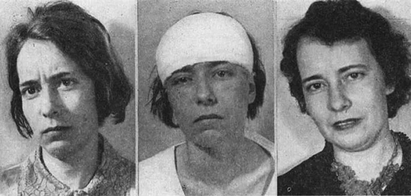 Блог - До и после лоботомии: 15 тревожных снимков, как эта процедура изменила жизнь навсегда До и после лоботомии: 15 тревожных снимков, как эта процедура изменила жизнь навсегда