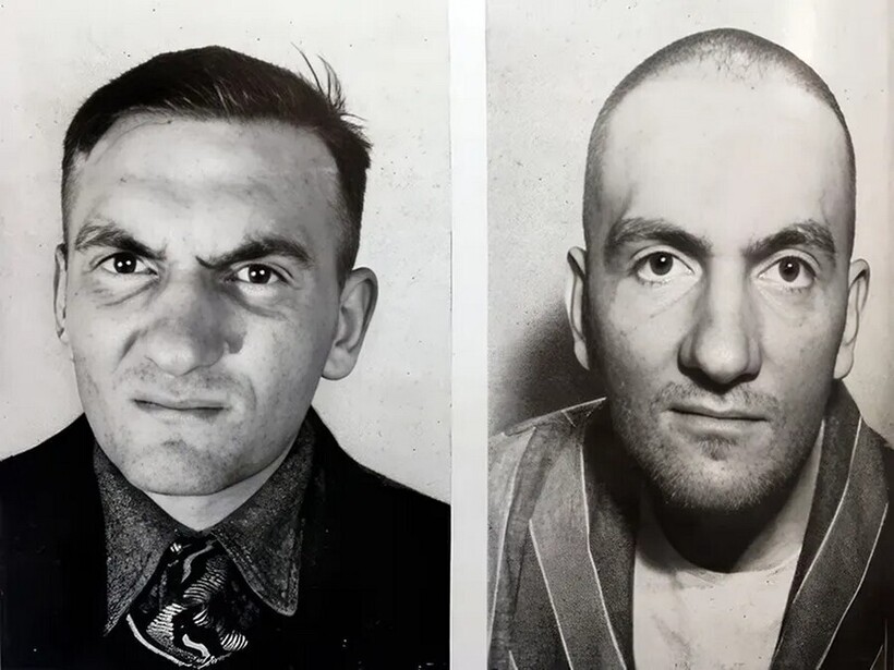 Блог - До и после лоботомии: 15 тревожных снимков, как эта процедура изменила жизнь навсегда До и после лоботомии: 15 тревожных снимков, как эта процедура изменила жизнь навсегда