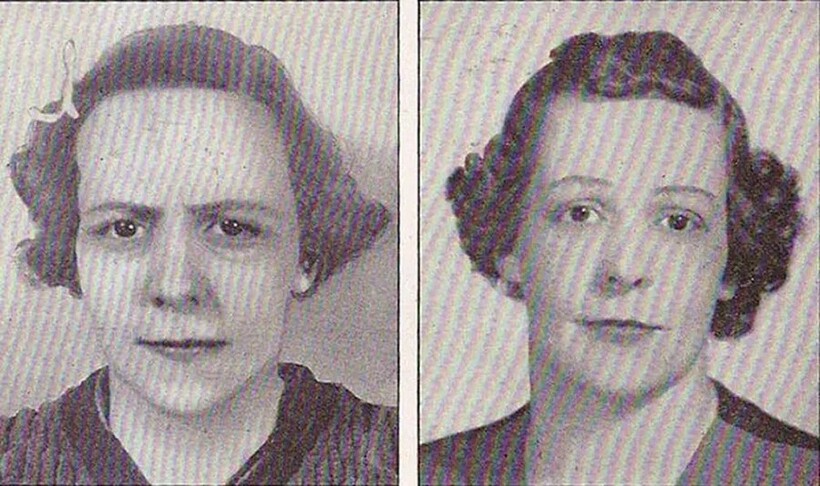 Блог - До и после лоботомии: 15 тревожных снимков, как эта процедура изменила жизнь навсегда До и после лоботомии: 15 тревожных снимков, как эта процедура изменила жизнь навсегда