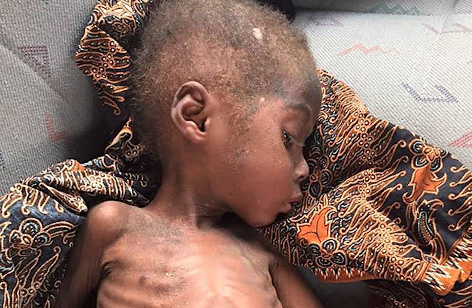 Этого 2-летнего малыша нашли умирающим на улице в Африке...