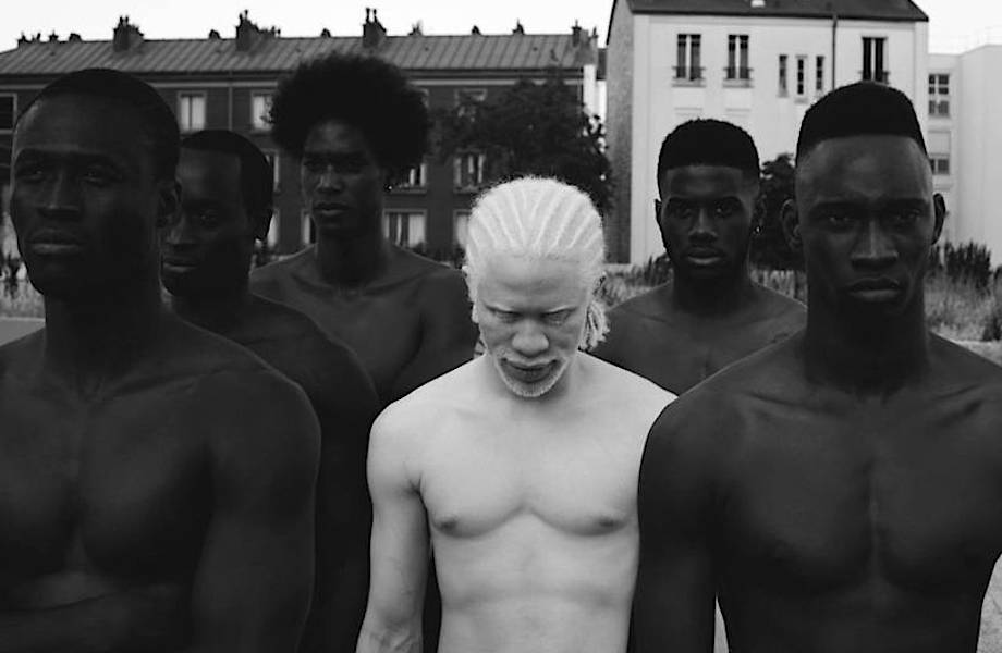 Фотограф показал гипнотизирующую красоту людей-альбиносов со всего мира 