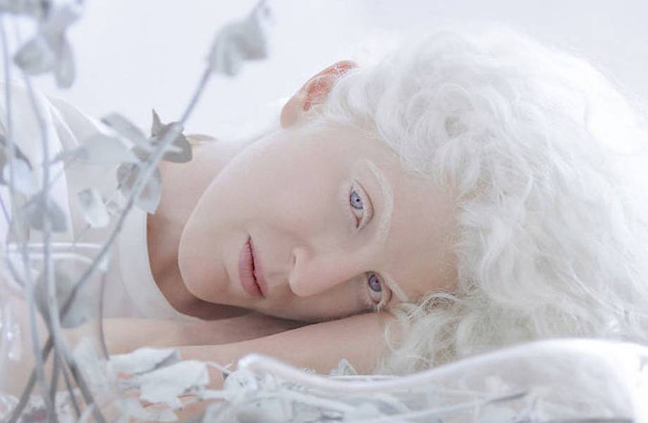 13 портретов людей-альбиносов, демонстрирующих их завораживающую красоту