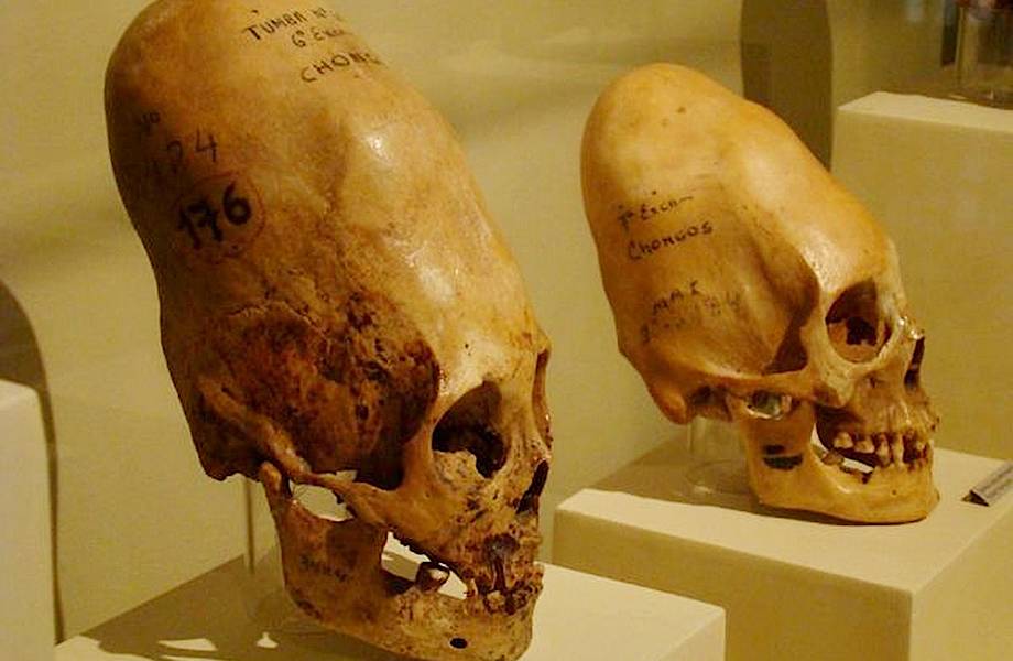 Вытянутые черепа: для чего разные народы мира применяли деформацию черепа 