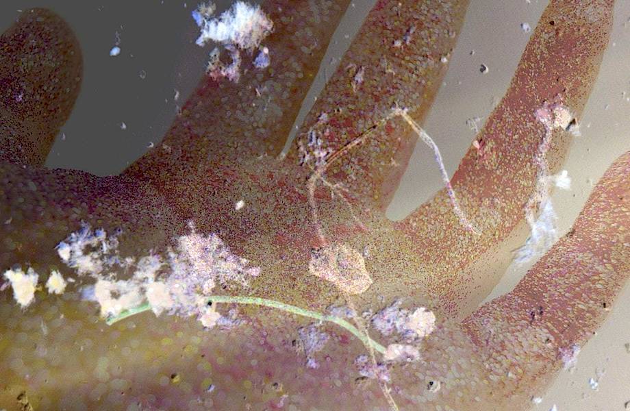 Микропластик внутри и вокруг нас: как крохотные частицы стали проблемой человечества
