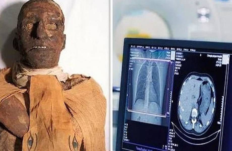 Современные технологии помогли египтологам раскрыть 3000-летнюю тайну убийства фараона