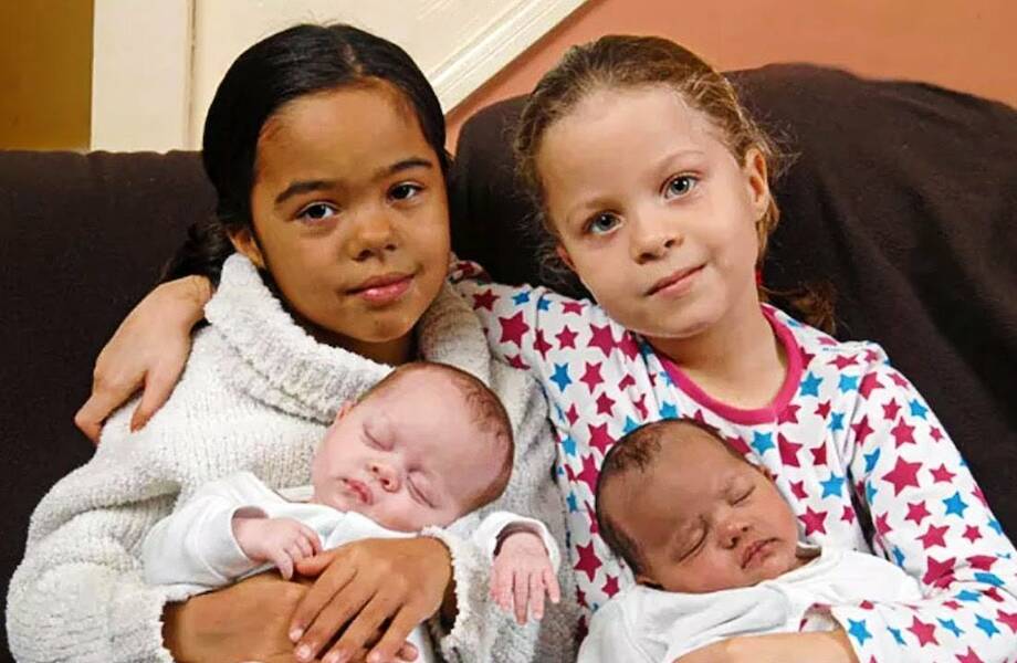 Женщина дважды подряд родила двухрасовых близнецов: вероятность такого — 1 к 1 000 000
